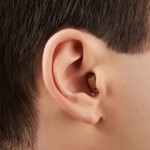 耳穴型補聴器を付けている写真