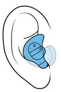 耳あな型補聴器を耳に入れたときのイメージ図