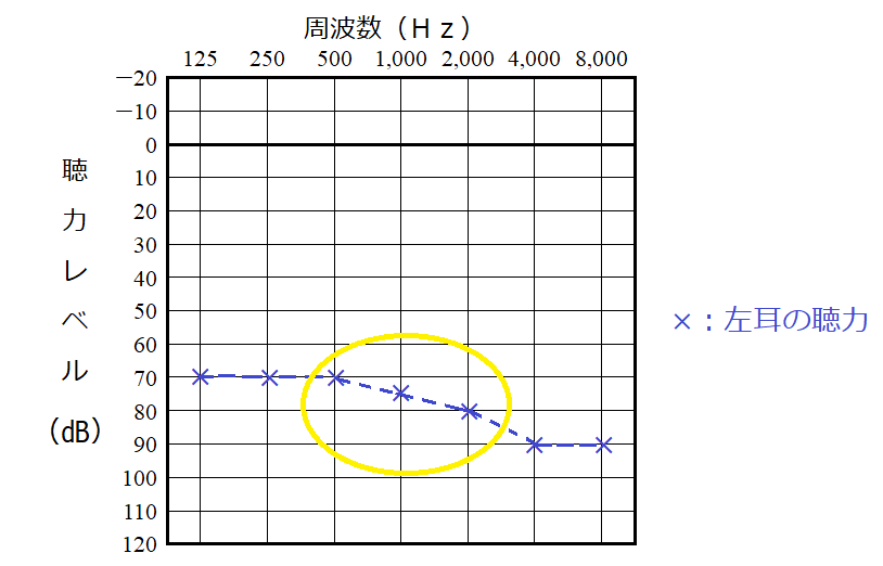 聴力レベルの計算の例、左耳の場合