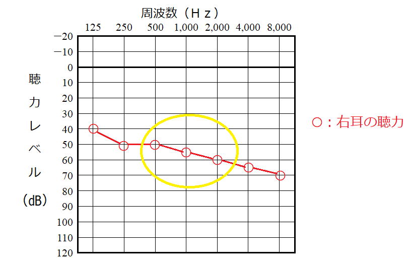 聴力レベルの計算の例、右耳の場合