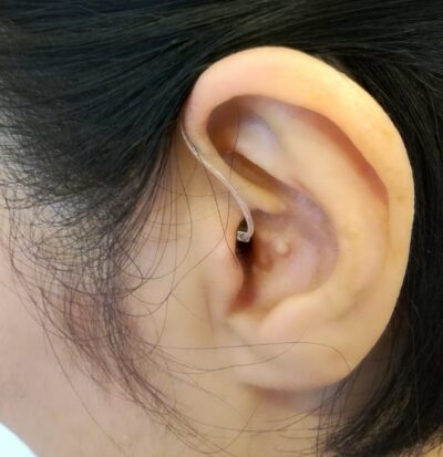 補聴器を着けると、部品が耳の中に入ります