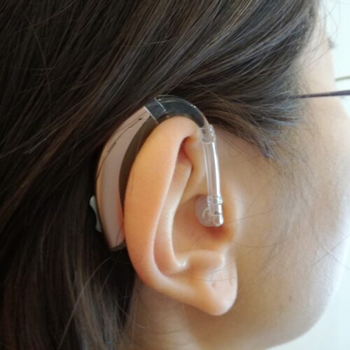 耳かけ型補聴器を装用した様子