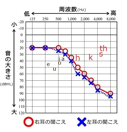 母音、子音成分を追記したオージオグラム