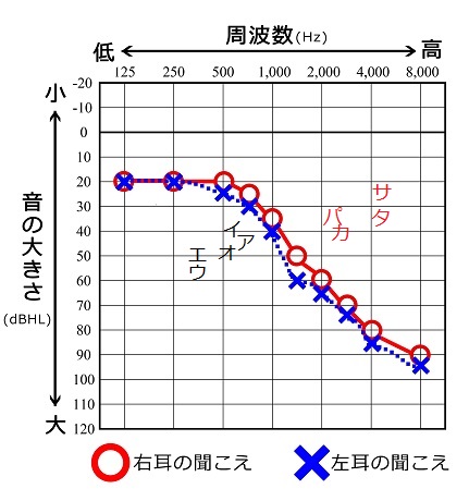 日本語の子音を追記したオージオグラム
