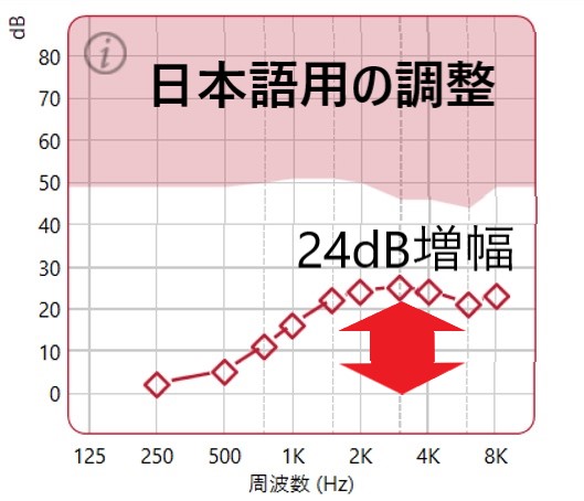 Gnリサウンド 補聴器の調整で英語が聞き取りやすくなった 70代男性の事例 補聴器専門店プロショップ大塚 認定補聴器技能者運営