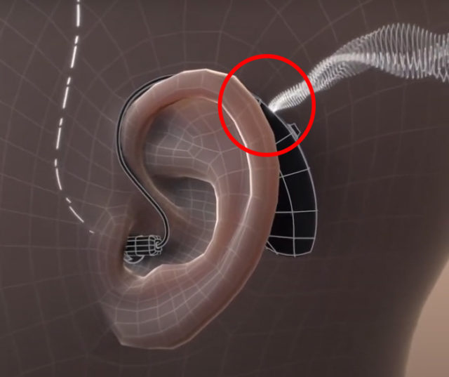 従来の補聴器では耳の上側マイクのみから音が入ります。