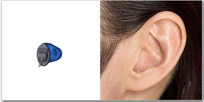 IIC補聴器と装用画像