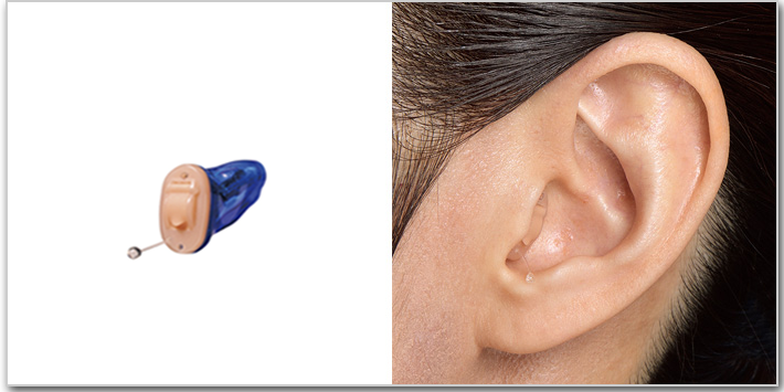 CIC補聴器と装用画像