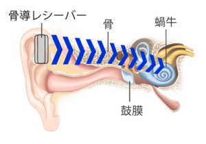 聴力検査の種類とそれぞれの見方