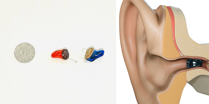 赤い補聴器がスターキーのIICサイズ、青い補聴器は他社製品。IICサイズの補聴器は耳の奥まで入り、しっかり隠れます。
